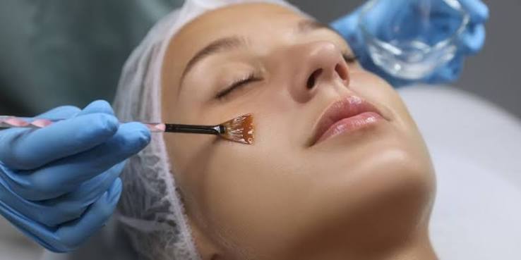Facial Peeling Treatment